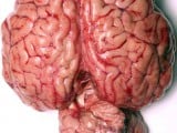 080418-human-brain-02.jpg