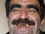 golden-teeth_3.jpg