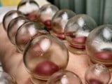 cupping-glass-1.jpg