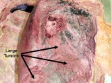 ThLungCancer-Table21.jpg