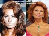 sophia-loren-plastic-surgery.jpg