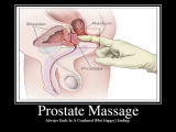 ProstateMassage[1].png