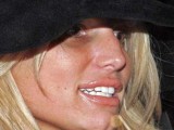 2006-01-jessica-simpson-black-eye.jpg