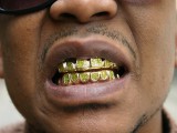 gold-teeth.jpg