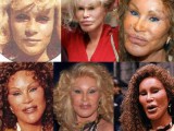 Jocelyn Wildenstein B & A.img_assist_custom.jpg