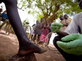 Guinea Worm.jpg