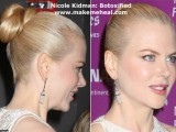 nicole-kidman-botox.jpg