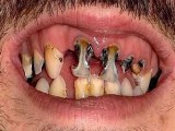 teeth.JPG