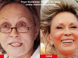 faye-dunaway-plastic-surgery.jpg