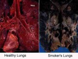 smokers-lungs.jpg