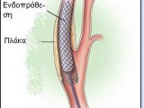 carotid.JPG